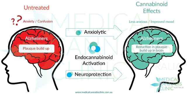 CBD History in Medicine