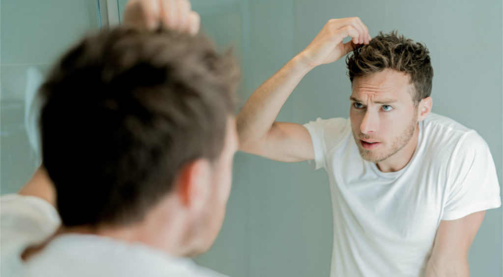 CBD for Hair Loss